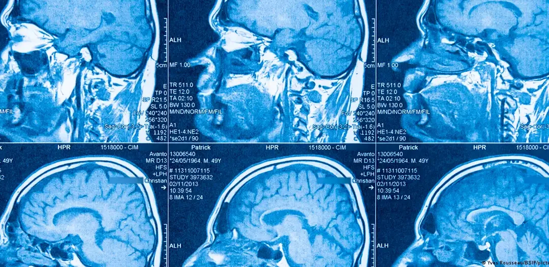 El cerebro humano no es uno, sino dos órganos